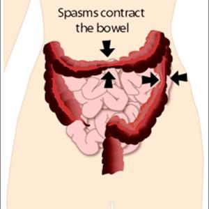 Bowel Irritable Sourcebook Syndrome - IBS Now Most Reported Gastrointestinal Disorder